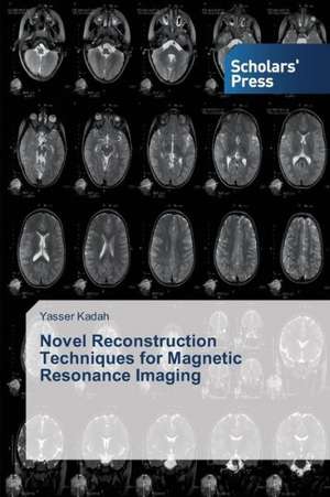 Novel Reconstruction Techniques for Magnetic Resonance Imaging de Yasser Kadah