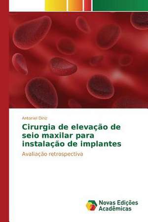 Cirurgia de Elevacao de Seio Maxilar Para Instalacao de Implantes: Fotoluminescencia E Crescimento de Nanoparticulas de Antoniel Diniz