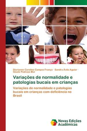 Variacoes de Normalidade E Patologias Bucais Em Criancas: Essencia Do Ser de Diurianne Caroline Campos França