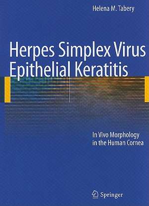 Herpes Simplex Virus Epithelial Keratitis: In Vivo Morphology in the Human Cornea de Helena M. Tabery