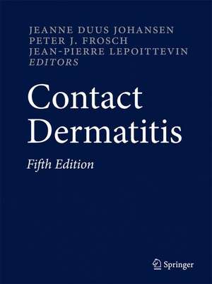 Contact Dermatitis de Jeanne Duus Johansen