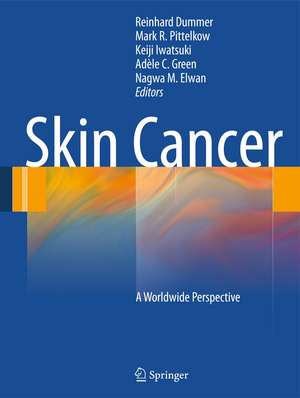 Skin Cancer - A World-Wide Perspective de Reinhard Dummer