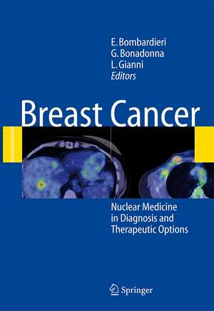 Breast Cancer: Nuclear Medicine in Diagnosis and Therapeutic Options de Emilio Bombardieri