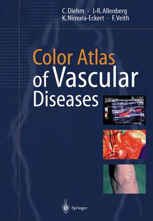 Color Atlas of Vascular Diseases de C. Diehm