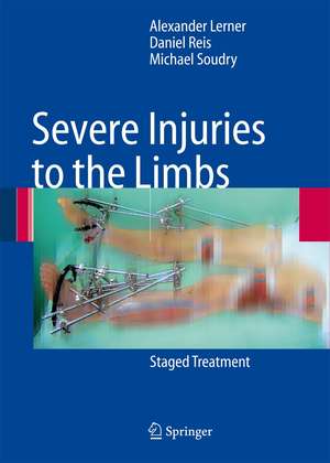 Severe Injuries to the Limbs: Staged Treatment de Alexander Lerner