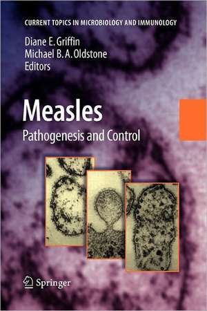 Measles: Pathogenesis and Control de Diane E. Griffin