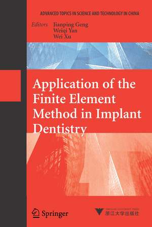 Application of the Finite Element Method in Implant Dentistry de Jianping Geng