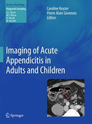 Imaging of Acute Appendicitis in Adults and Children de Caroline KEYZER