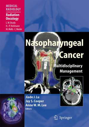 Nasopharyngeal Cancer: Multidisciplinary Management de Jiade J. Lu