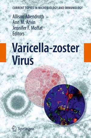 Varicella-zoster Virus de Allison Abendroth