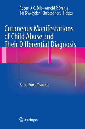 Cutaneous Manifestations of Child Abuse and Their Differential Diagnosis: Blunt Force Trauma de Robert A. C. Bilo