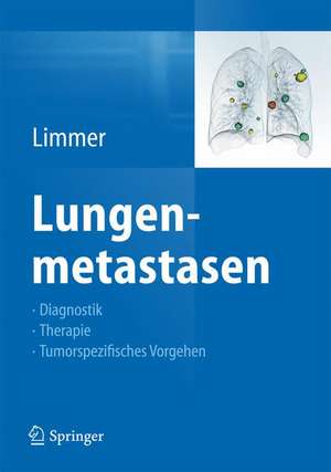 Lungenmetastasen: Diagnostik - Therapie - Tumorspezifisches Vorgehen de Stefan Limmer