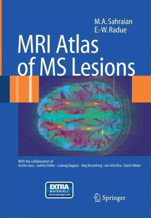 MRI Atlas of MS Lesions de M.A. Sahraian