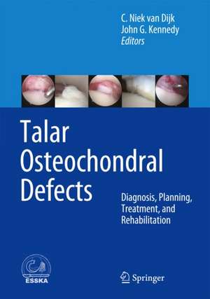 Talar Osteochondral Defects: Diagnosis, Planning, Treatment, and Rehabilitation de C. Niek van Dijk