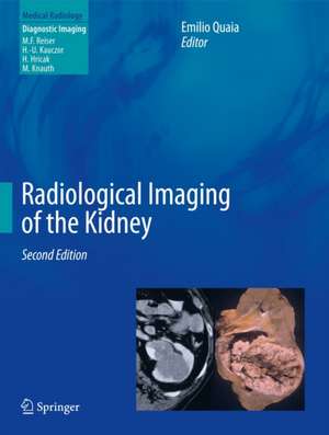 Radiological Imaging of the Kidney de Emilio Quaia