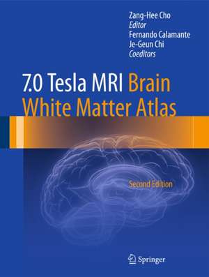 7.0 Tesla MRI Brain White Matter Atlas de Zang-Hee Cho