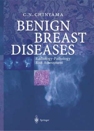 Benign Breast Diseases: Radiology — Pathology — Risk Assessment de Catherine N. Chinyama