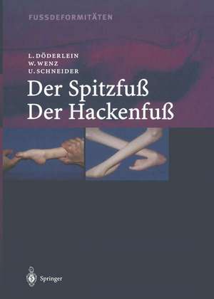 Fussdeformitäten: Der Spitzfuss/Der Hackenfuss de Leonhard Döderlein