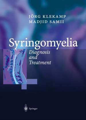 Syringomyelia: Diagnosis and Treatment de C. Matthies