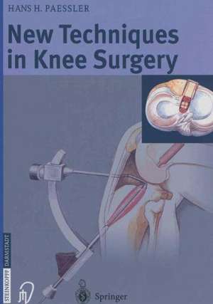 New Techniques in Knee Surgery de H.H. Paessler