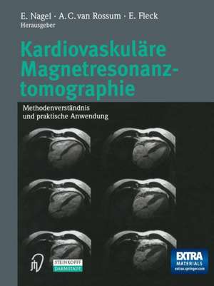 Kardiovaskuläre Magnetresonanztomographie: Methodenverständnis und praktische Anwendung de E. Nagel