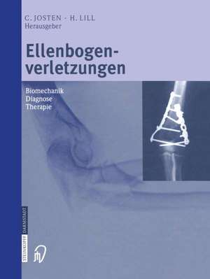 Ellenbogenverletzungen: Biomechanik ■ Diagnose ■ Therapie de C. Josten