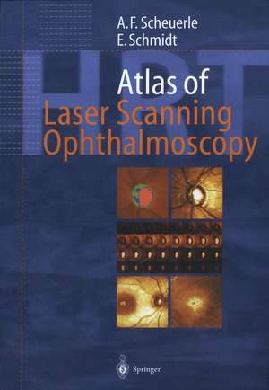 Atlas of Laser Scanning Ophthalmoscopy de Alexander Friedrich Scheuerle