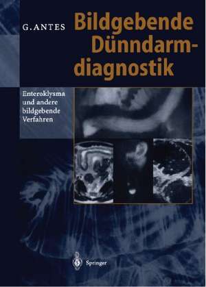 Bildgebende Dünndarmdiagnostik: Enteroklysma und andere bildgebende Verfahren de Günther Antes