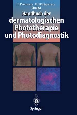 Handbuch der dermatologischen Phototherapie und Photodiagnostik de Jean Krutmann