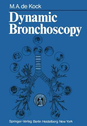 Dynamic Bronchoscopy de M. A. de Kock