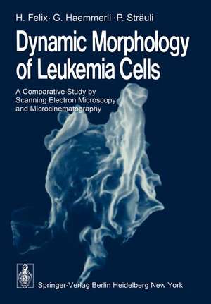 Dynamic Morphology of Leukemia Cells: A Comparative Study by Scanning Electron Microscopy and Microcinematography de H. Felix