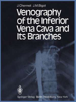 Venography of the Inferior Vena Cava and Its Branches de J. Chermet