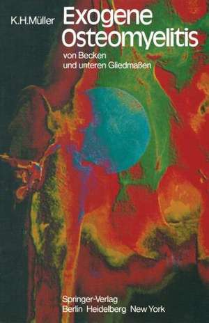 Exogene Osteomyelitis von Becken und unteren Gliedmaßen: Besonderheiten Pathogenese Klinik Therapie Ergebnisse de K. H. Müller