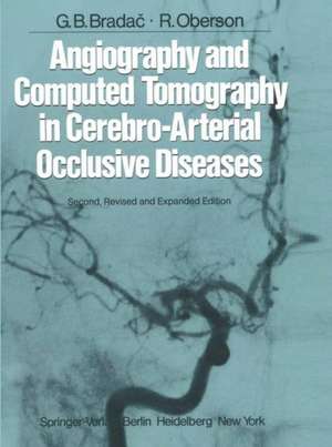 Angiography and Computed Tomography in Cerebro-Arterial Occlusive Diseases de J.-M. Taveras