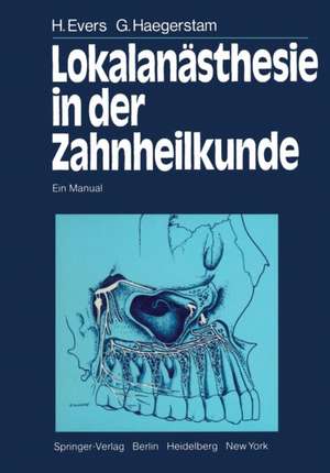 Lokalanästhesie in der Zahnheilkunde: Ein Manual de H. Evers