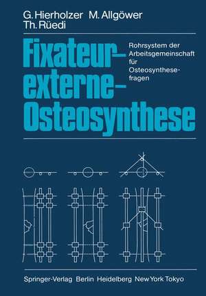 Fixateur-externe-Osteosynthese: Rohrsystem der Arbeitsgemeinschaft für Osteosynthesefragen de G. Hierholzer