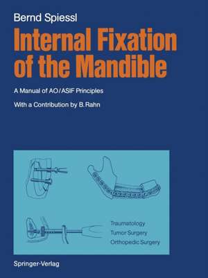 Internal Fixation of the Mandible: A Manual of AO/ASIF Principles de Berton A. Rahn