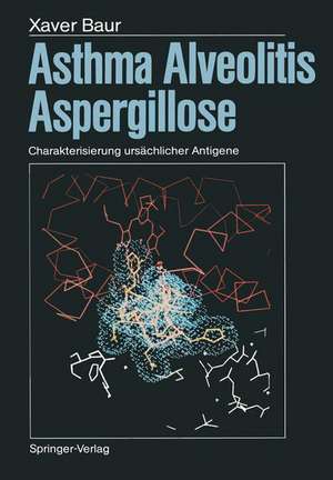 Asthma, Alveolitis, Aspergillose: Charakterisierung ursächlicher Antigene de Mahmoud Dewair