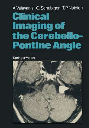 Clinical Imaging of the Cerebello-Pontine Angle de Anton Valavanis