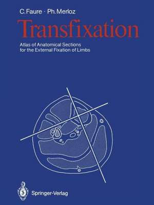 Transfixation: Atlas of Anatomical Sections for the External Fixation of Limbs de Claude Faure