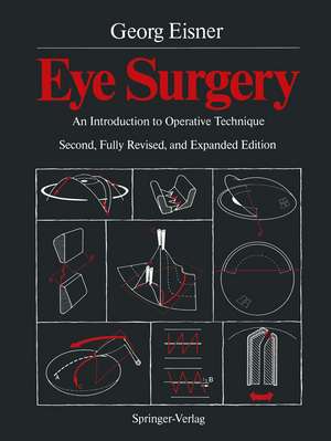 Eye Surgery: An Introduction to Operative Technique de Terry C. Telger