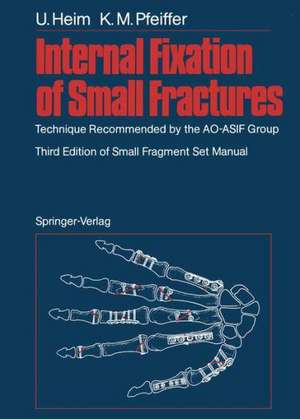 Internal Fixation of Small Fractures: Technique Recommended by the AO-ASIF Group de J. Brennwald