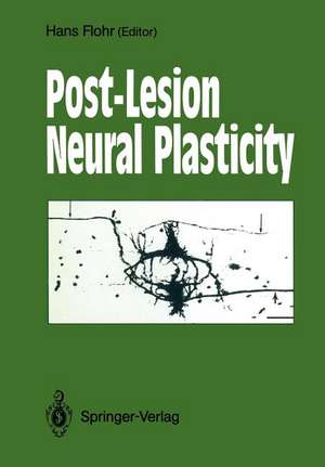 Post-Lesion Neural Plasticity de Hans Flohr