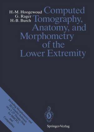 Computed Tomography, Anatomy, and Morphometry of the Lower Extremity de P. Cerutti