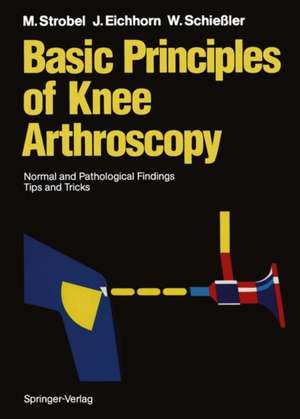 Basic Principles of Knee Arthroscopy: Normal and Pathological Findings Tips and Tricks de Willemijn M. Klein