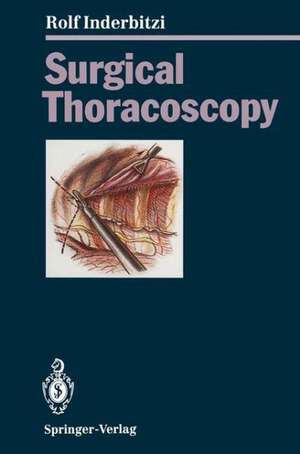 Surgical Thoracoscopy de Rolf Gilbert Carl Inderbitzi