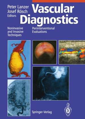 Vascular Diagnostics: Noninvasive and Invasive Techniques Periinterventional Evaluations de Peter Lanzer