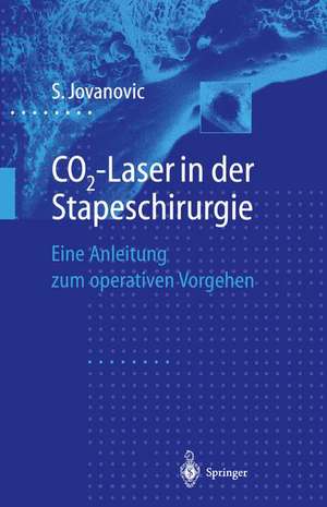 CO2-Laser in der Stapeschirurgie: Eine Anleitung zum operativen Vorgehen de Sergije Jovanovic