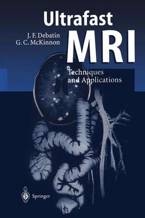 Ultrafast MRI: Techniques and Applications de I. Berry