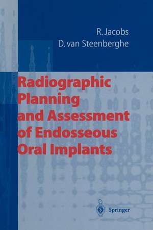 Radiographic Planning and Assessment of Endosseous Oral Implants de Reinhilde Jacobs